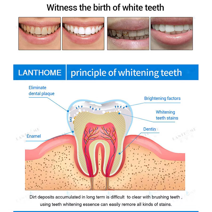 Best Sellers 50% off - Teeth Whitening Essence