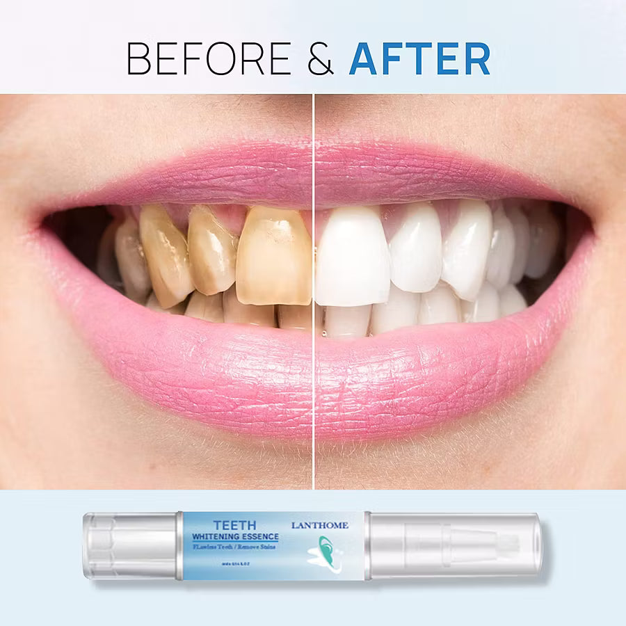 Best Sellers 50% off - Teeth Whitening Essence
